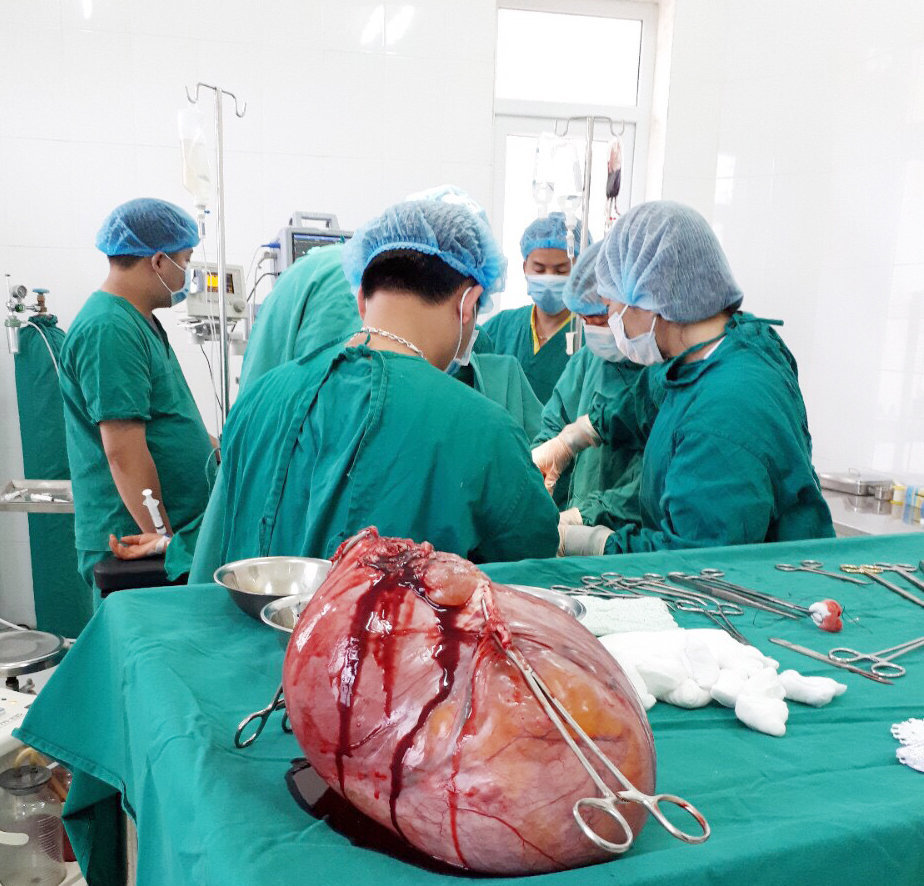 Ca phẫu thuật cắt khối u xơ tử cung nặng 6kg tại Bệnh viện Đa khoa huyện Quản Bạ