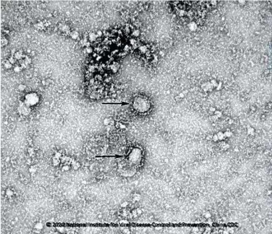 Hình ảnh Coronavirus  được công bố tại Trung Quốc (St)