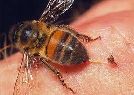 Cần lấy vòi chích của ong khi bị ong đốt. (Ảnh nguồn Internet)