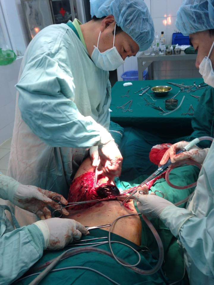 Bác sỹ Tạ Tiến Mạnh cùng các đồng nghiệp thực hiện ca mổ khó cứu sống người bệnh