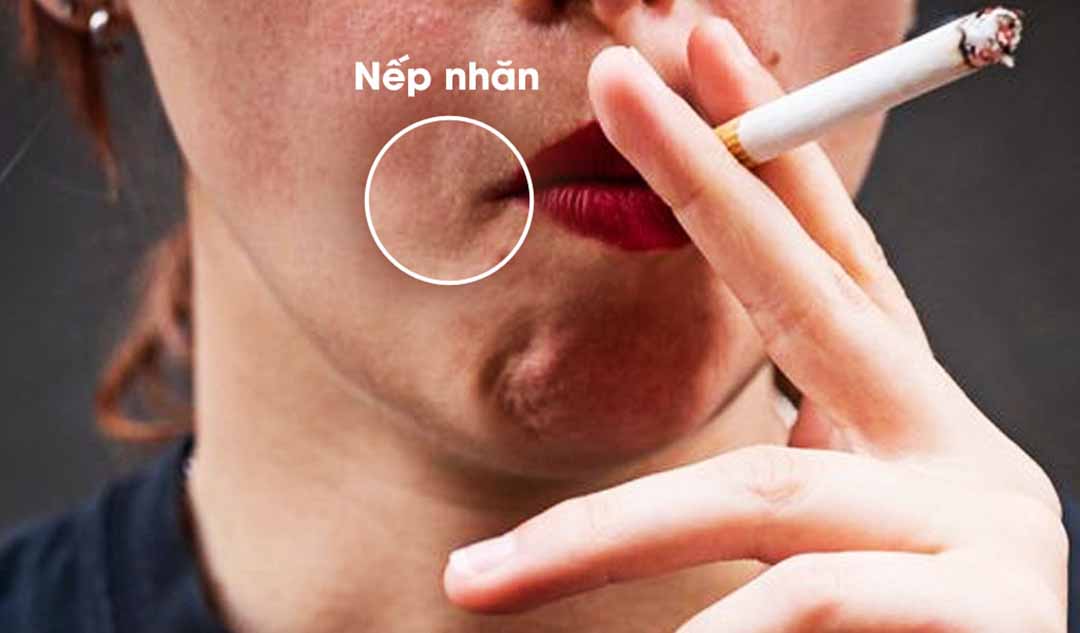 Hút thuốc lá gây ảnh hưởng nghiêm trọng đến làn da (Nguồn Internet)